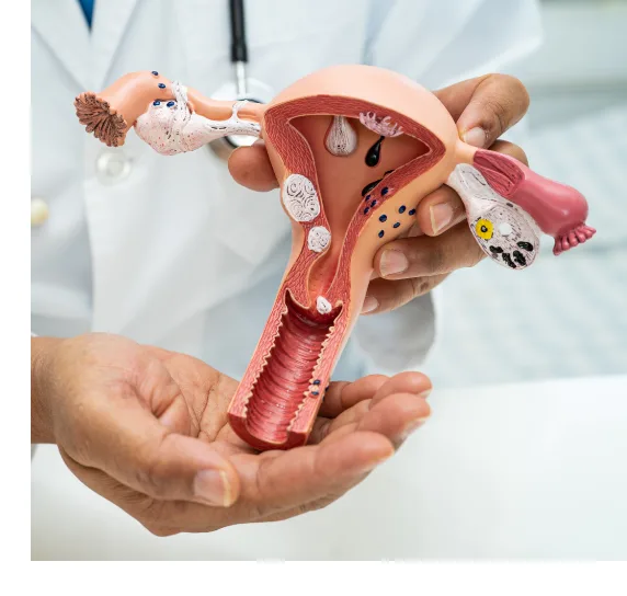 Dr holding a 3d replica anatomy of a cervix